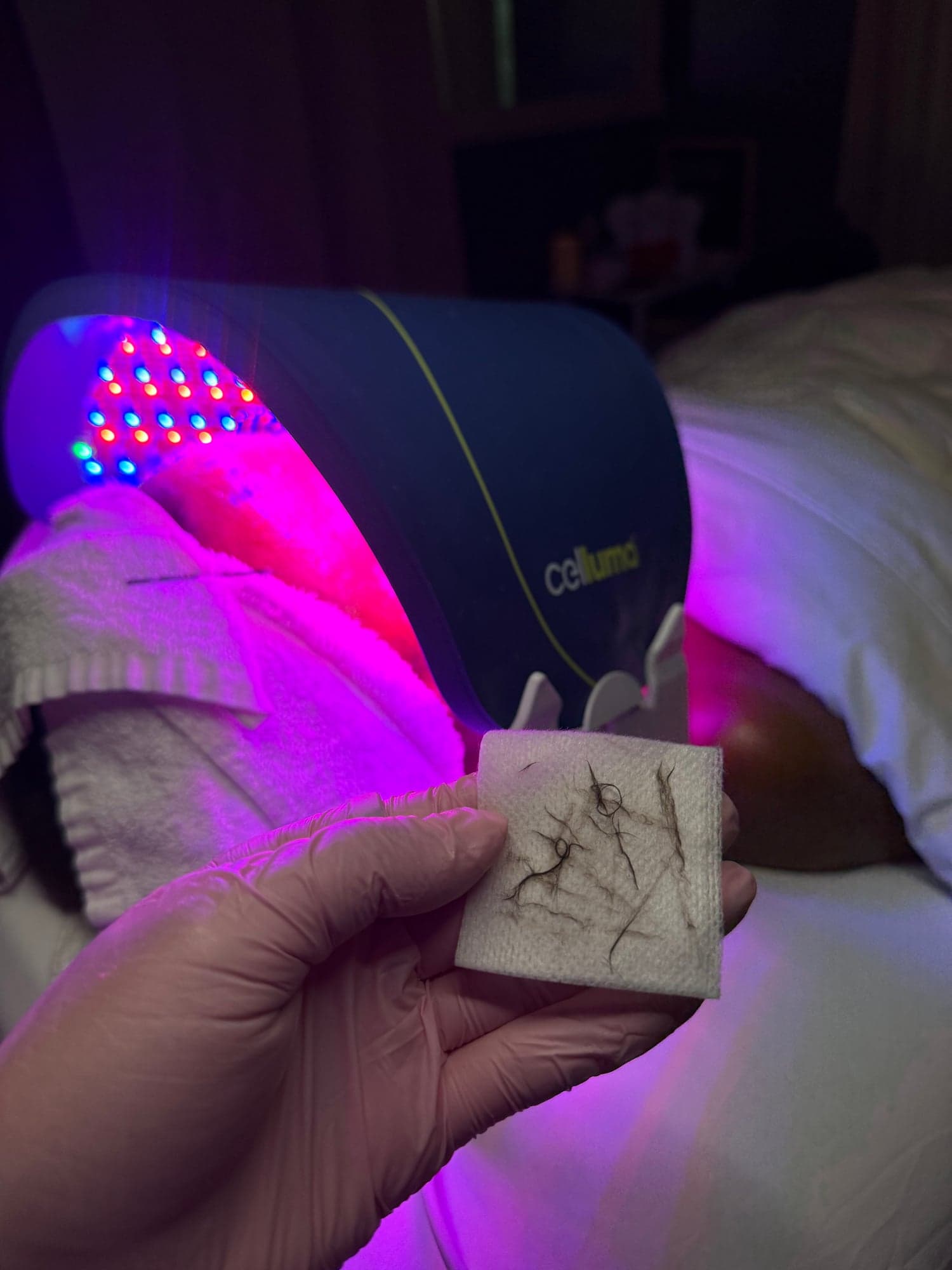 LED light therapy under a Celluma panel during a treatment
