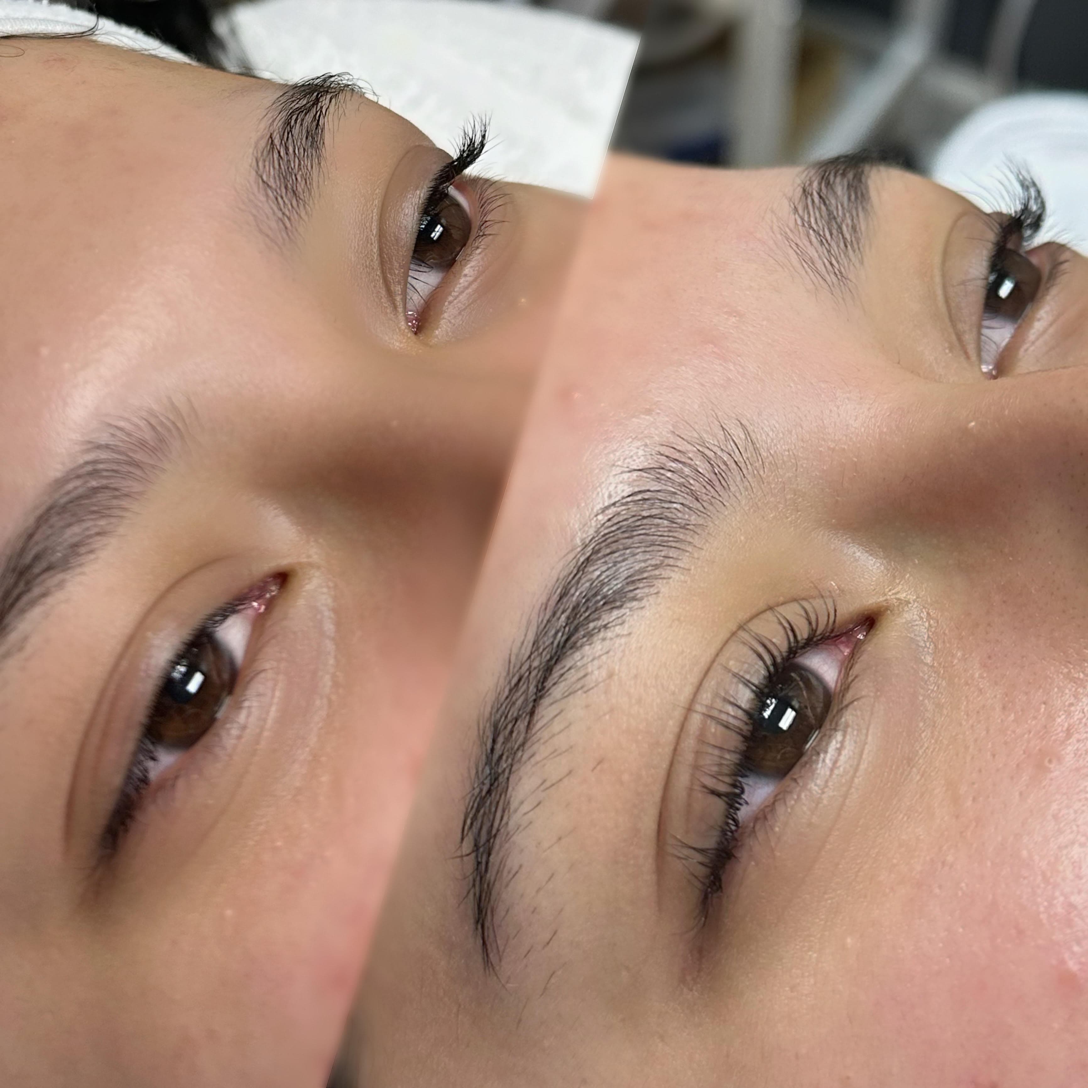 Professional dermaplaning treatment